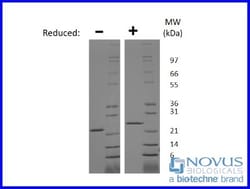 Novus Biologicals™ Recombinant Rat Prolactin Animal-Free Protein